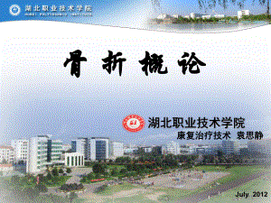 骨折實習(xí)講課用ppt課件