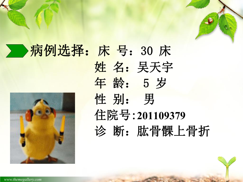 肱骨髁上骨折.ppt_第3页