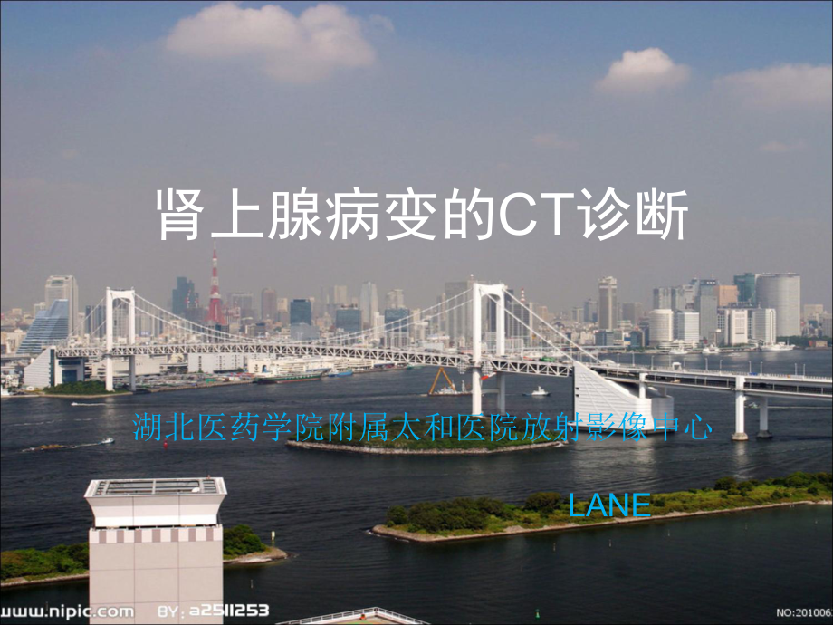 肾上腺病变CT诊断_第1页