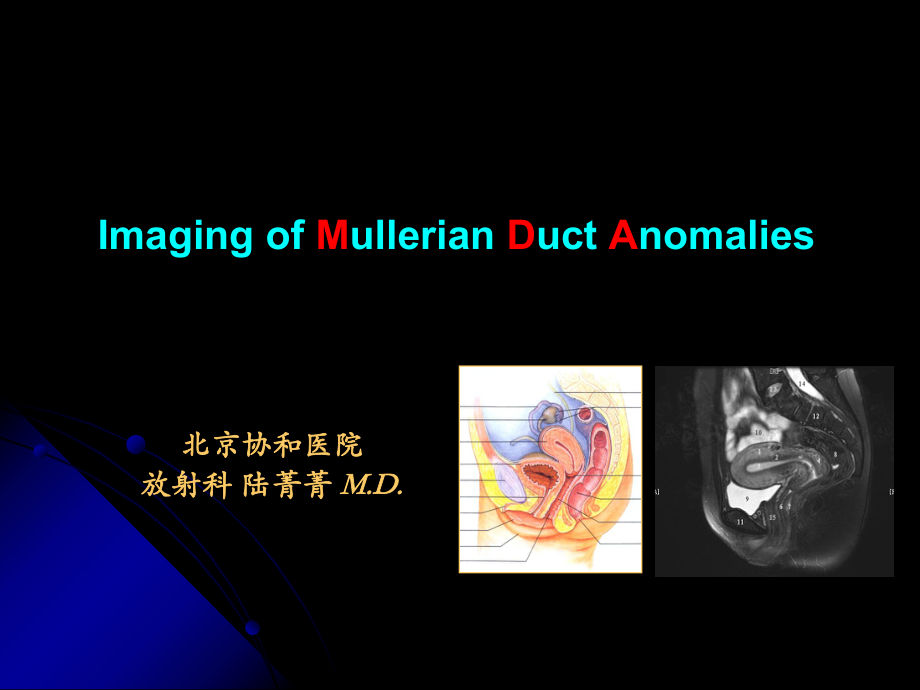 苗勒氏管畸形的影像学诊断北京协和医院_第1页